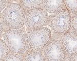 POLR2A Antibody in Immunohistochemistry (Paraffin) (IHC (P))