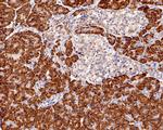 S6 Antibody in Immunohistochemistry (Paraffin) (IHC (P))