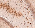 S6 Antibody in Immunohistochemistry (Paraffin) (IHC (P))