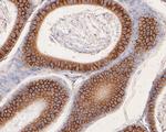 CD166 (ALCAM) Antibody in Immunohistochemistry (Paraffin) (IHC (P))