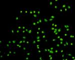 H3K9me3 Antibody in Immunocytochemistry (ICC/IF)