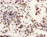 H3K9me3 Antibody in Immunohistochemistry (Paraffin) (IHC (P))