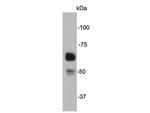 Catalase Antibody in Western Blot (WB)