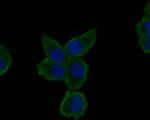 A2M Antibody in Immunocytochemistry (ICC/IF)