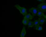 A2M Antibody in Immunocytochemistry (ICC/IF)