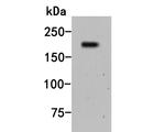 A2M Antibody in Western Blot (WB)