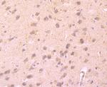 CD137 (4-1BB) Antibody in Immunohistochemistry (Paraffin) (IHC (P))