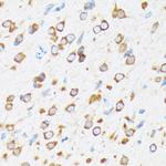 ELP3 Antibody in Immunohistochemistry (Paraffin) (IHC (P))