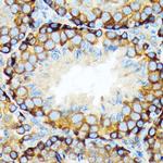 ELP3 Antibody in Immunohistochemistry (Paraffin) (IHC (P))