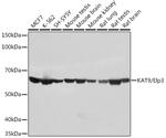 ELP3 Antibody in Western Blot (WB)