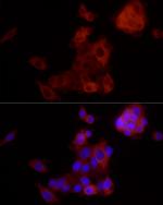 ALDH1A1 Antibody in Immunocytochemistry (ICC/IF)