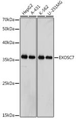 EXOSC7 Antibody in Western Blot (WB)