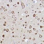 CARS Antibody in Immunohistochemistry (Paraffin) (IHC (P))