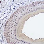 SERPINB3 Antibody in Immunohistochemistry (Paraffin) (IHC (P))