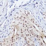 SERPINB3 Antibody in Immunohistochemistry (Paraffin) (IHC (P))