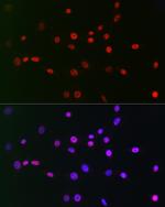 CtBP2 Antibody in Immunocytochemistry (ICC/IF)