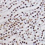 CtBP2 Antibody in Immunohistochemistry (Paraffin) (IHC (P))