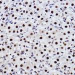 CtBP2 Antibody in Immunohistochemistry (Paraffin) (IHC (P))