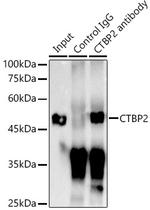 CtBP2 Antibody in Immunoprecipitation (IP)