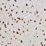 UBE2B Antibody in Immunohistochemistry (Paraffin) (IHC (P))