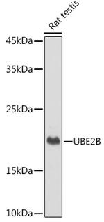 UBE2B Antibody in Western Blot (WB)