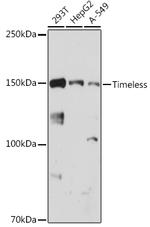 TIMELESS Antibody in Western Blot (WB)