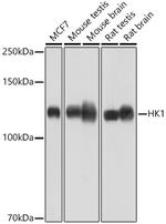 HK1 Antibody in Western Blot (WB)