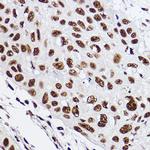 GTF2F2 Antibody in Immunohistochemistry (Paraffin) (IHC (P))