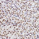 GTF2F2 Antibody in Immunohistochemistry (Paraffin) (IHC (P))