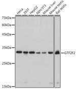 GTF2F2 Antibody in Western Blot (WB)