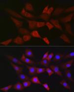 PGD Antibody in Immunocytochemistry (ICC/IF)