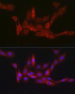 PGD Antibody in Immunocytochemistry (ICC/IF)