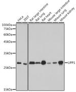 UPP1 Antibody in Western Blot (WB)