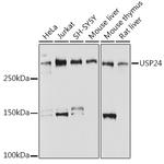 USP24 Antibody in Western Blot (WB)