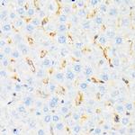 CSK Antibody in Immunohistochemistry (Paraffin) (IHC (P))