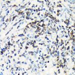 CSK Antibody in Immunohistochemistry (Paraffin) (IHC (P))