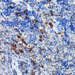 CSK Antibody in Immunohistochemistry (Paraffin) (IHC (P))