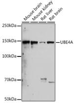 UBE4A Antibody in Western Blot (WB)