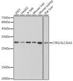 CTR1 Antibody in Western Blot (WB)