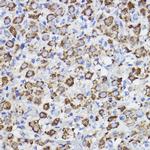 ERLIN2 Antibody in Immunohistochemistry (Paraffin) (IHC (P))