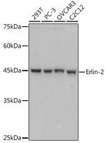 ERLIN2 Antibody in Western Blot (WB)