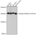 Collagen III Antibody in Western Blot (WB)