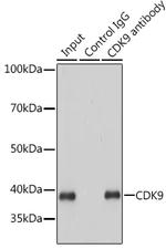 CDK9 Antibody in Immunoprecipitation (IP)