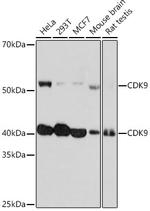 CDK9 Antibody in Western Blot (WB)