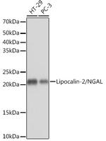 NGAL Antibody in Western Blot (WB)