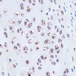 Aggrecan Antibody in Immunohistochemistry (Paraffin) (IHC (P))