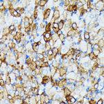 JAK1 Antibody in Immunohistochemistry (Paraffin) (IHC (P))