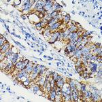 JAK1 Antibody in Immunohistochemistry (Paraffin) (IHC (P))