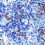 S100A8 Antibody in Immunohistochemistry (Paraffin) (IHC (P))