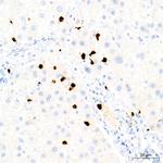 Myeloperoxidase Antibody in Immunohistochemistry (Paraffin) (IHC (P))